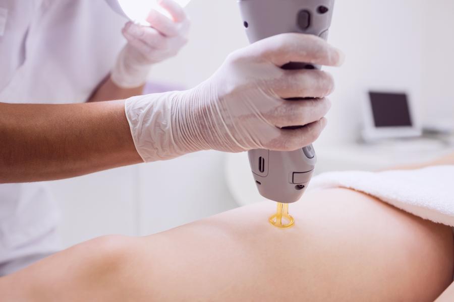 fraktionierte co2-lasertherapie für glatte, jugendliche haut