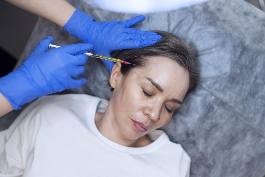vampir-lifting und prp-therapie für hautverjüngung