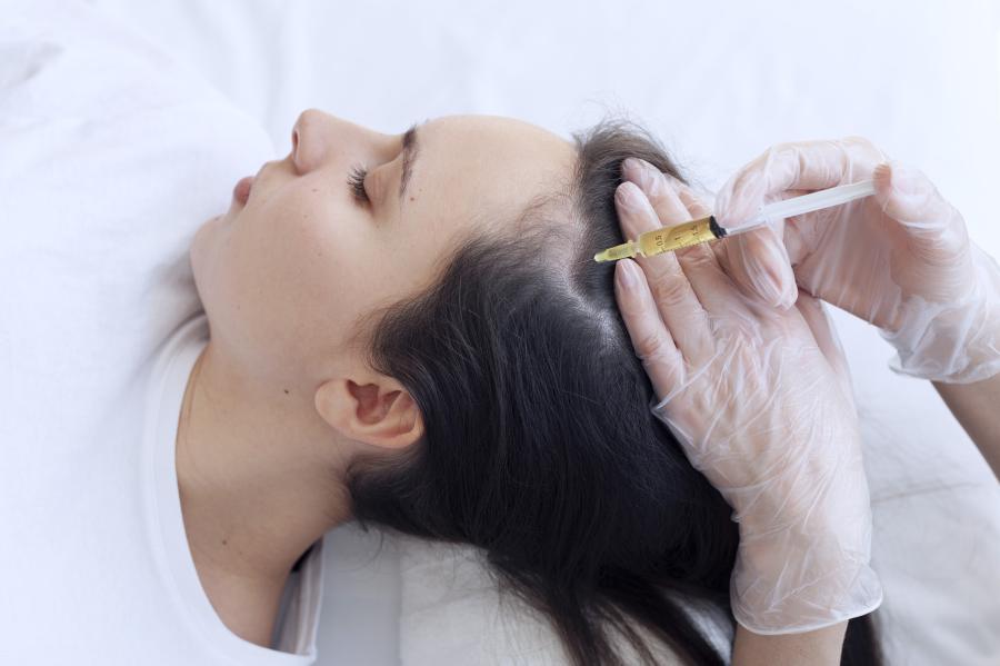 prp-therapie für haare – natürliche behandlung bei haarausfall