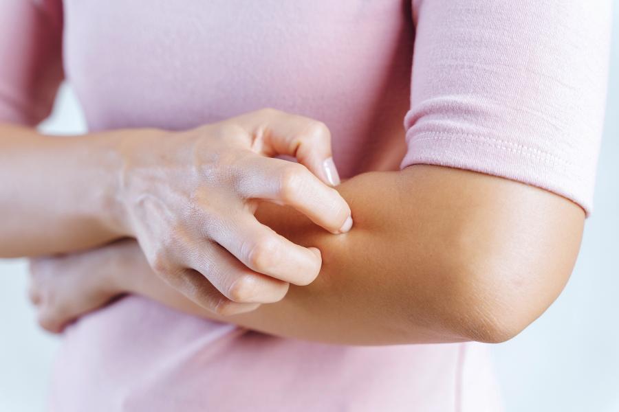 juckreiz (pruritus) – ursachen, symptome und therapie