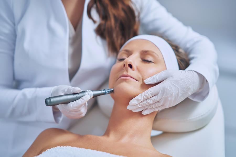microneedling – sanfte hautverjüngung ohne op
