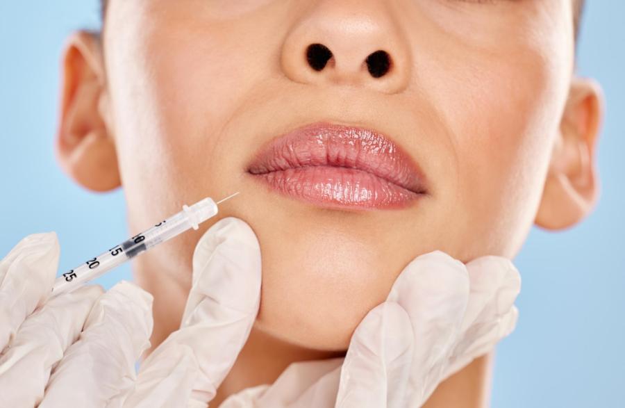 lippenkonturierung mit hyaluronsäure für natürliche fülle