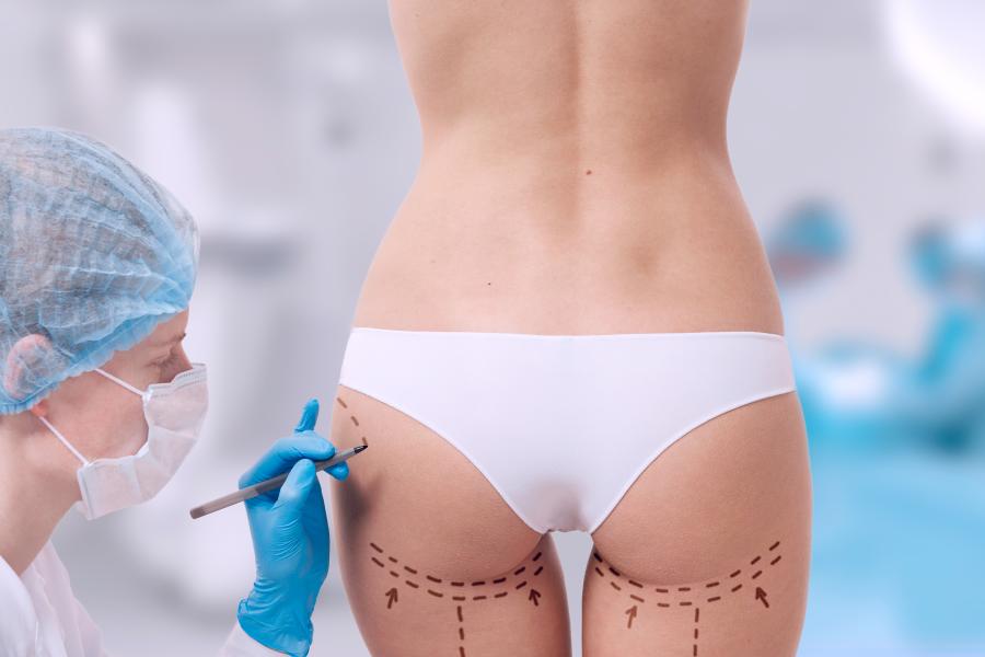 Ästhetische chirurgie