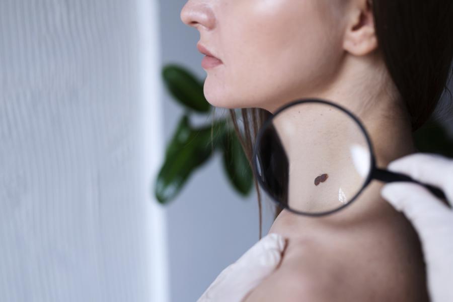 hautarzt zürich | dermatologie zürich
